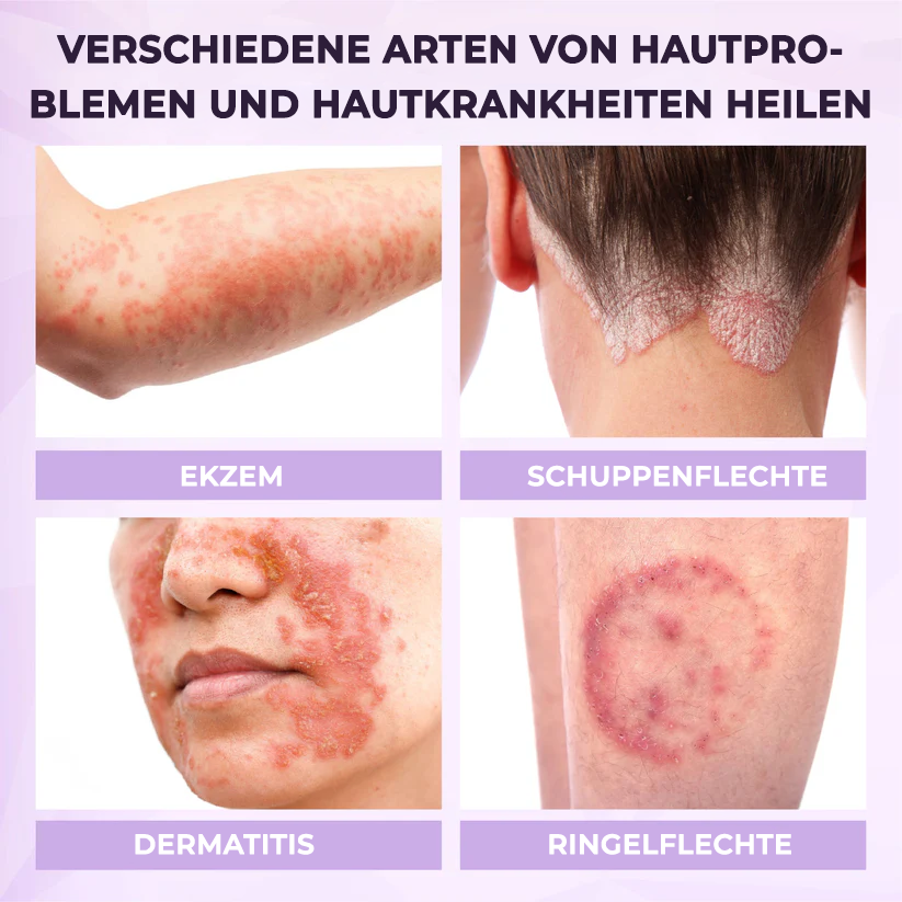 Fivfivgo® Lila Mais Multi-Condition Hautspray