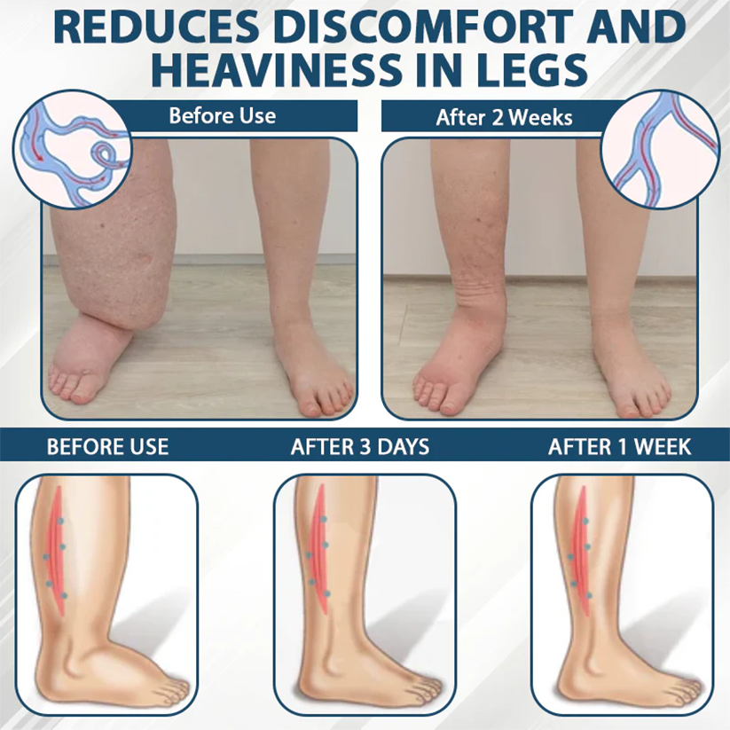 Fivfivgo® VenoHerb Black Cumin Edema Relief Balm