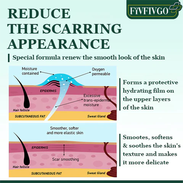 Fivfivgo™ Advanced Scar Repair Serum für alle Arten von Narben – insbesondere Aknenarben, Operationsnarben und Dehnungsstreifen