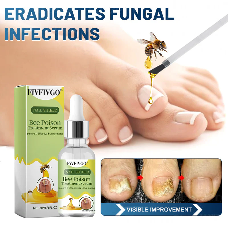 Fivfivgo™ Nagelpilz Bienengift Behandlung Serum