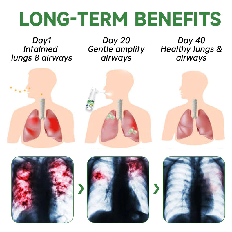 Fivfivgo™ BreathDetox Herbal Lung Cleansing Spray