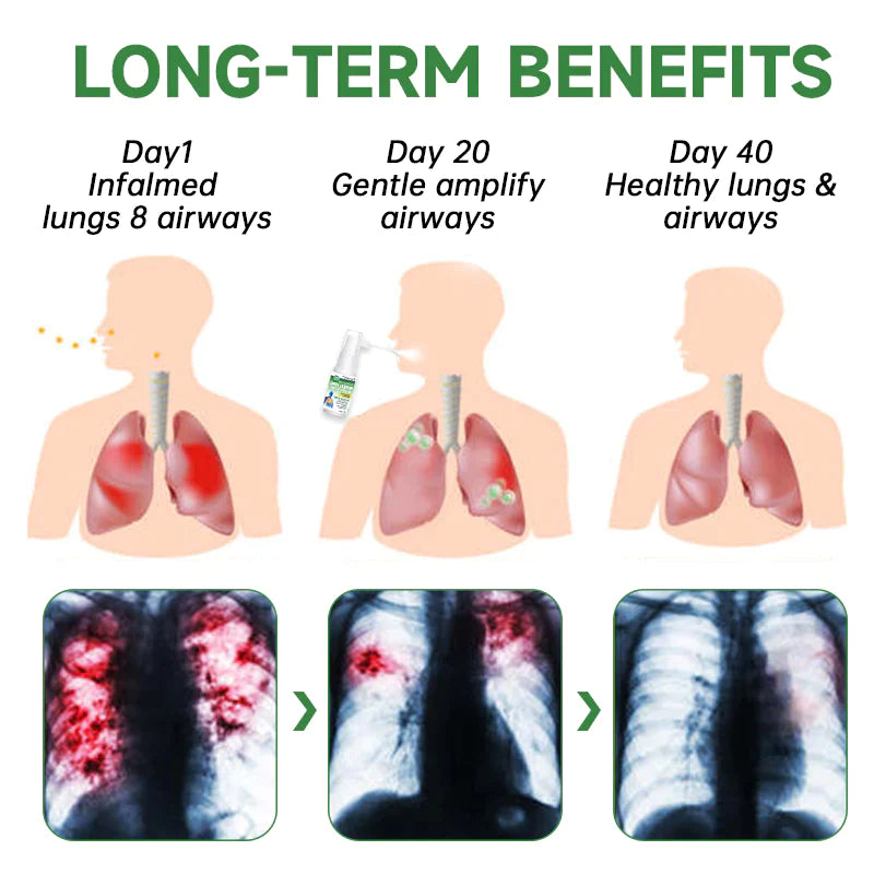 Fivfivgo™ BreathDetox Spray à base de plantes pour le nettoyage des poumons