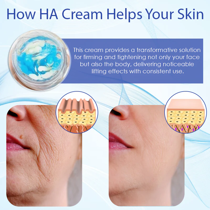 Fivfivgo™ Deep Elastic SkinRenew HA Cream