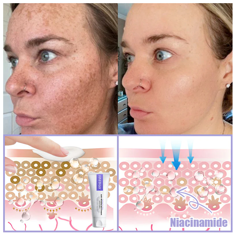 Fivfivgo® Anti-Falten-Hautcreme zum Entfernen von Falten, Straffen der Haut, Aufhellen - Last Day Sale🔥90% OFF