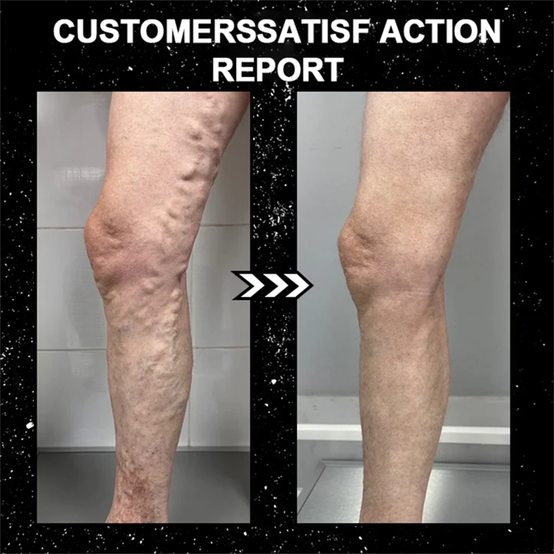 Chaussettes sculptantes Fivfivgo™ Ice Silk Ion Fiber Repair
