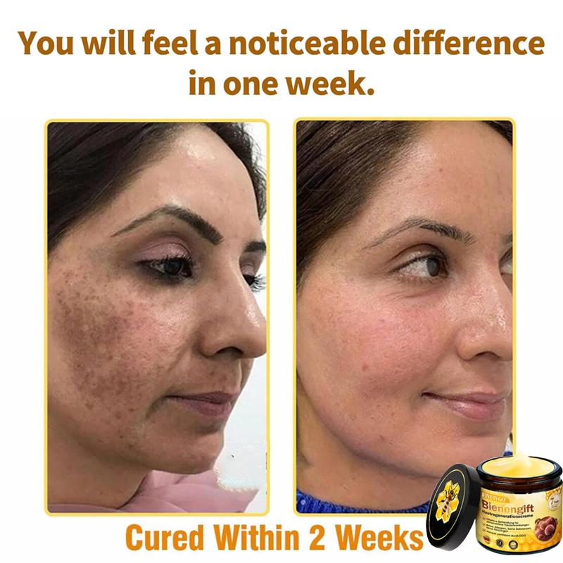 Fivfivgo™ Bee Venom Skin Regeneration Cream