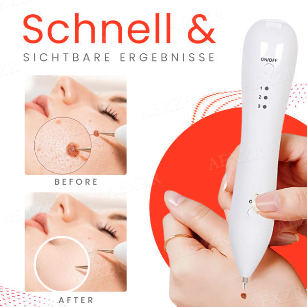 Fivfivgo™ Tragbarer Hautpflege-Laserstift