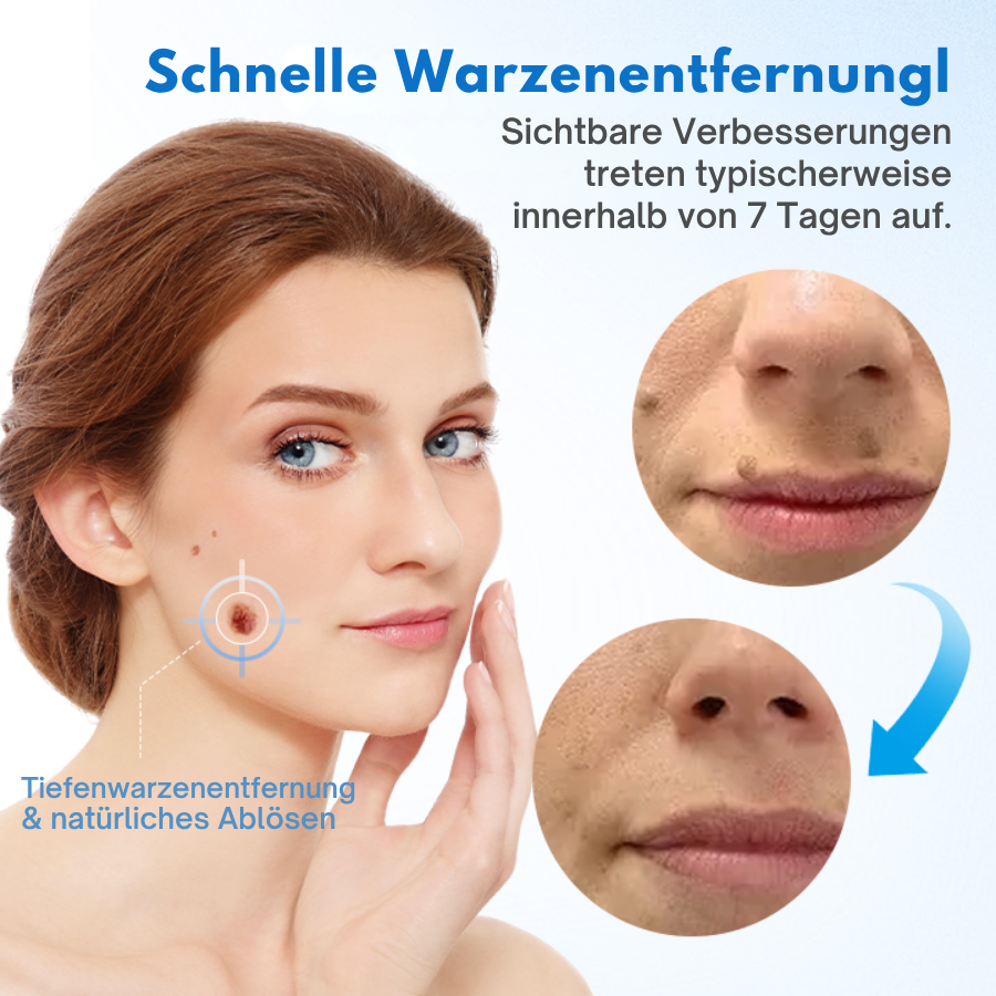 Fivfivgo® TagGone Warzenentfernungscreme
