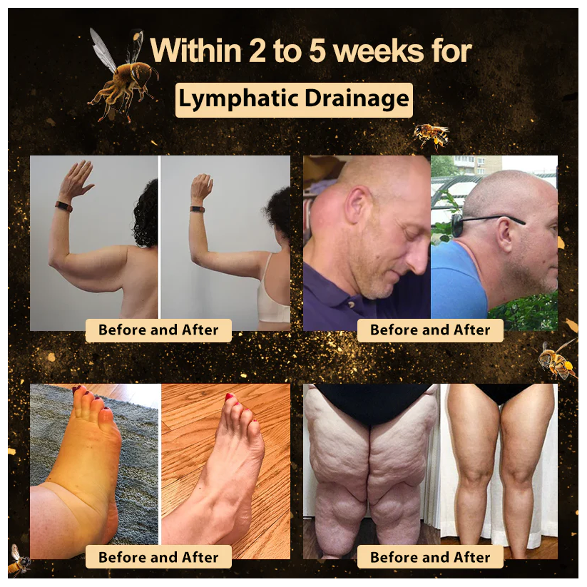 Fivfivgo™ 𝐁𝐞𝐞 𝐓𝐡𝐞𝐫𝐚𝐩𝐲 𝐆𝐢𝐧𝐠𝐞𝐫 𝐌𝐢𝐧𝐭 𝐒𝐥𝐢𝐦𝐦𝐢𝐧𝐠 𝐄𝐬𝐞𝐧𝐤𝐫𝐚𝐧𝐜𝐡