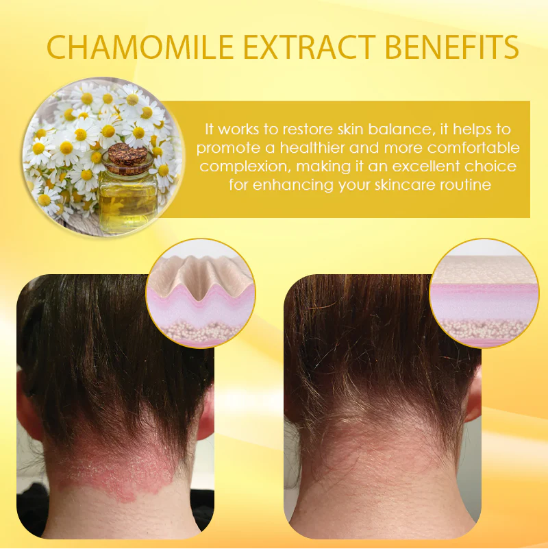 Fivfivgo™ Chamomile Skin Repairing Cleansing Pads