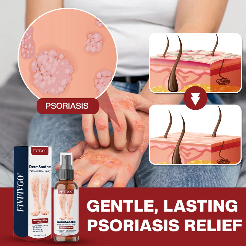 Fivfivgo® DermSoothe Psoriasis Relief Spray