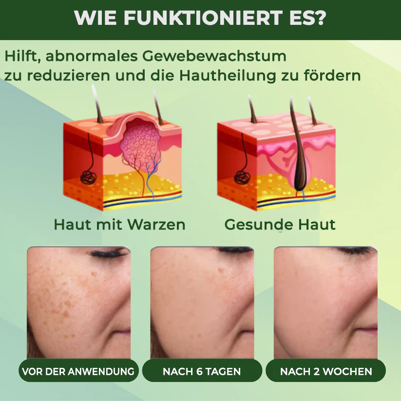 Fivfivgo® Reedle Shot 100 Tag & Spot Zielscheibe Fortgeschrittenes Serum