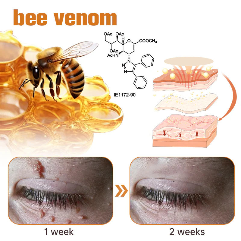 Fivfivgo™ WartGone Bienengift-Behandlung Patch
