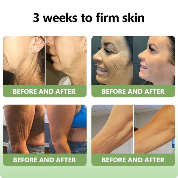 Fivfivgo™ Luxurious Collagen Peptide Firming Cream