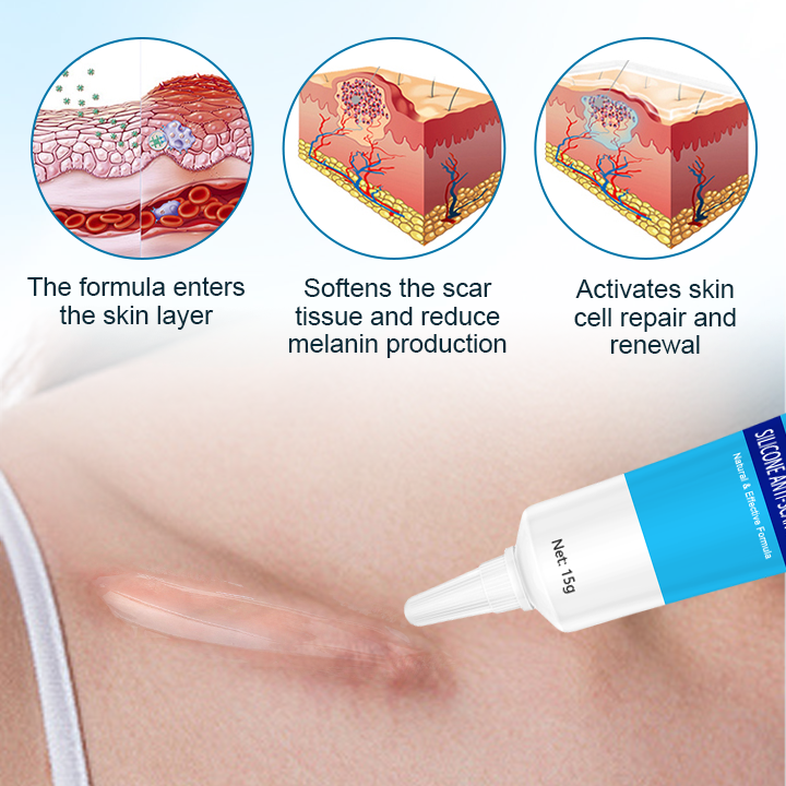 Fivfivgo™ Silikon-Anti-Narbe-Creme