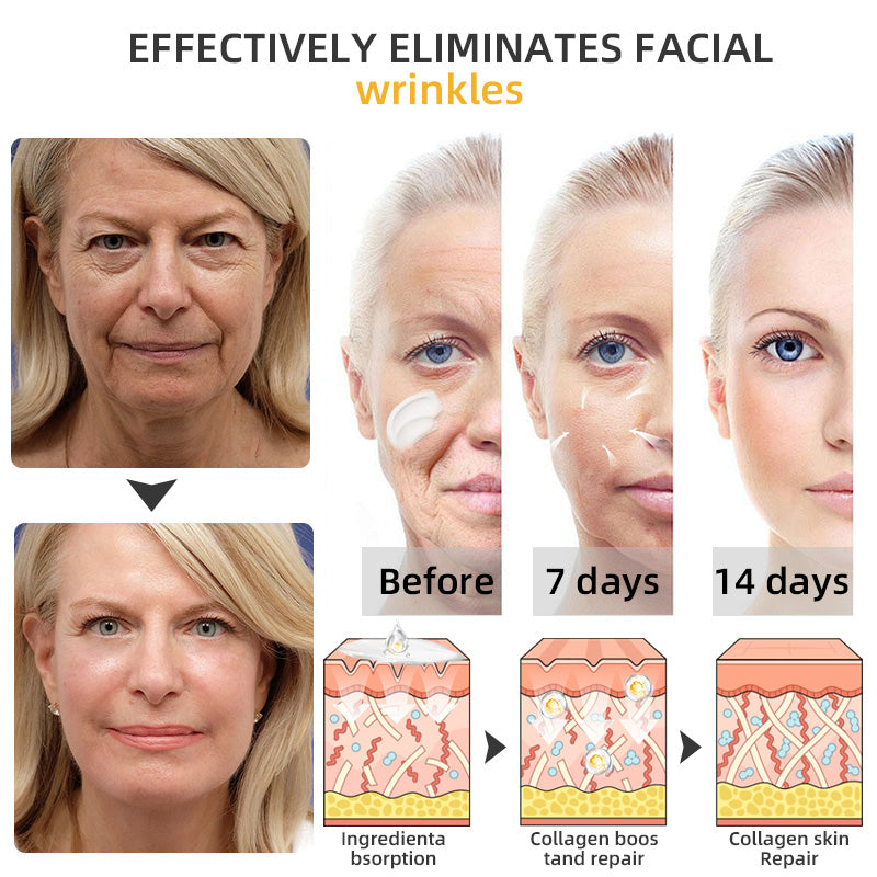 Fivfivgo™ BeeLift Anti-Aging Firming Cream (Address Crepe & Sagging) 🔥 LAST DAY SALE 70% OFF