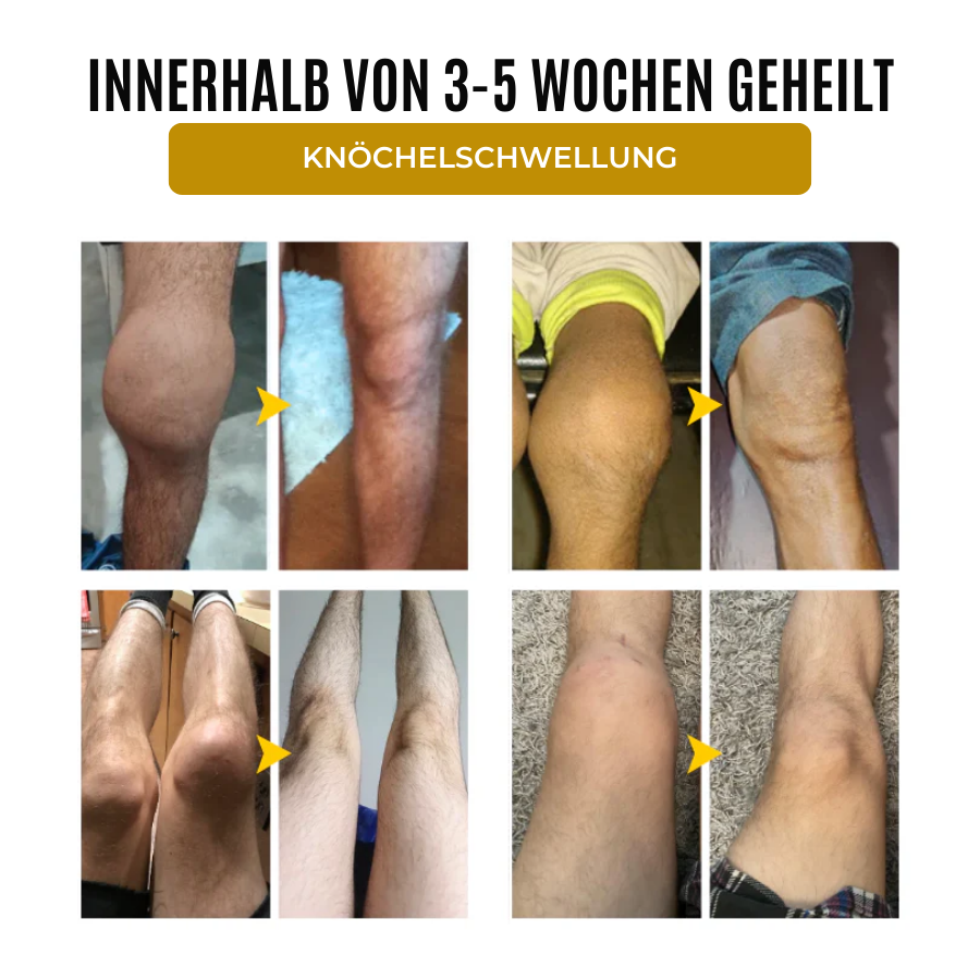 Fivfivgo® ArthroSoothe Kurkuma & Emuöl Schmerzlinderungs-Massagegel