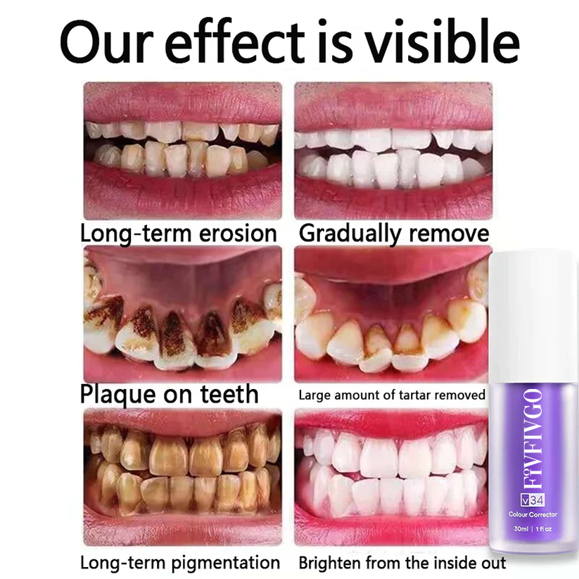 Fivfivgo™ Pure Herbal Teeth Whitening Mousse