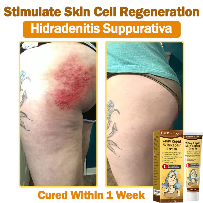 Fivfivgo™ 7-Day Rapid Skin Repaur Cream