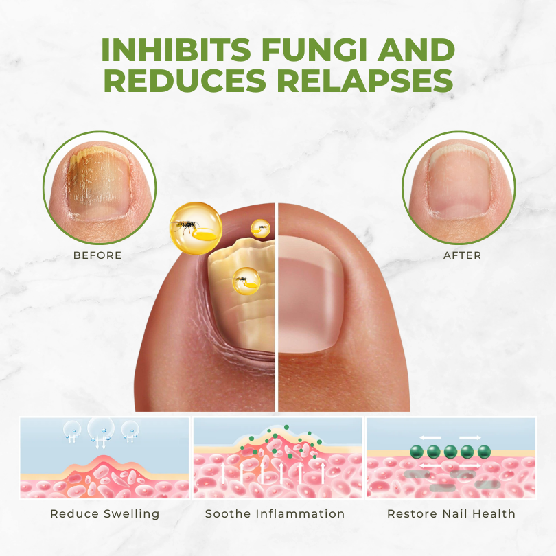 Fivfivgo™ FungiVanish Bienengift-Nagelbehandlungsöl