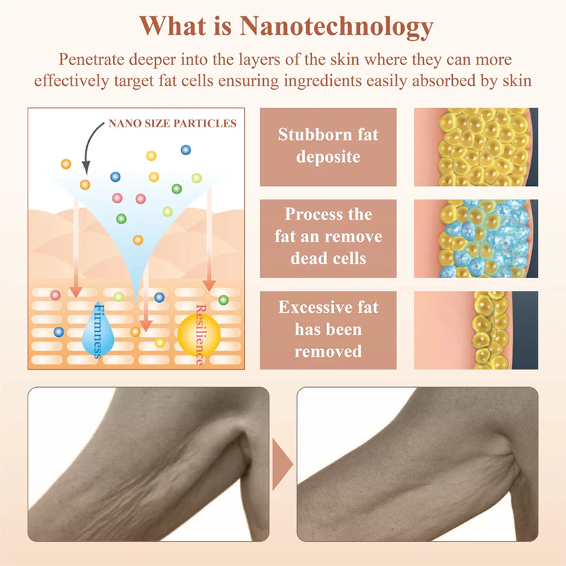 Fivfivgo™ Nano Hautstraffender Körpercremeroller
