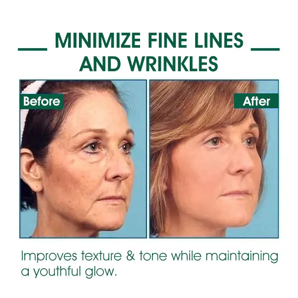 Fivfivgo™ Botox Facial Serum