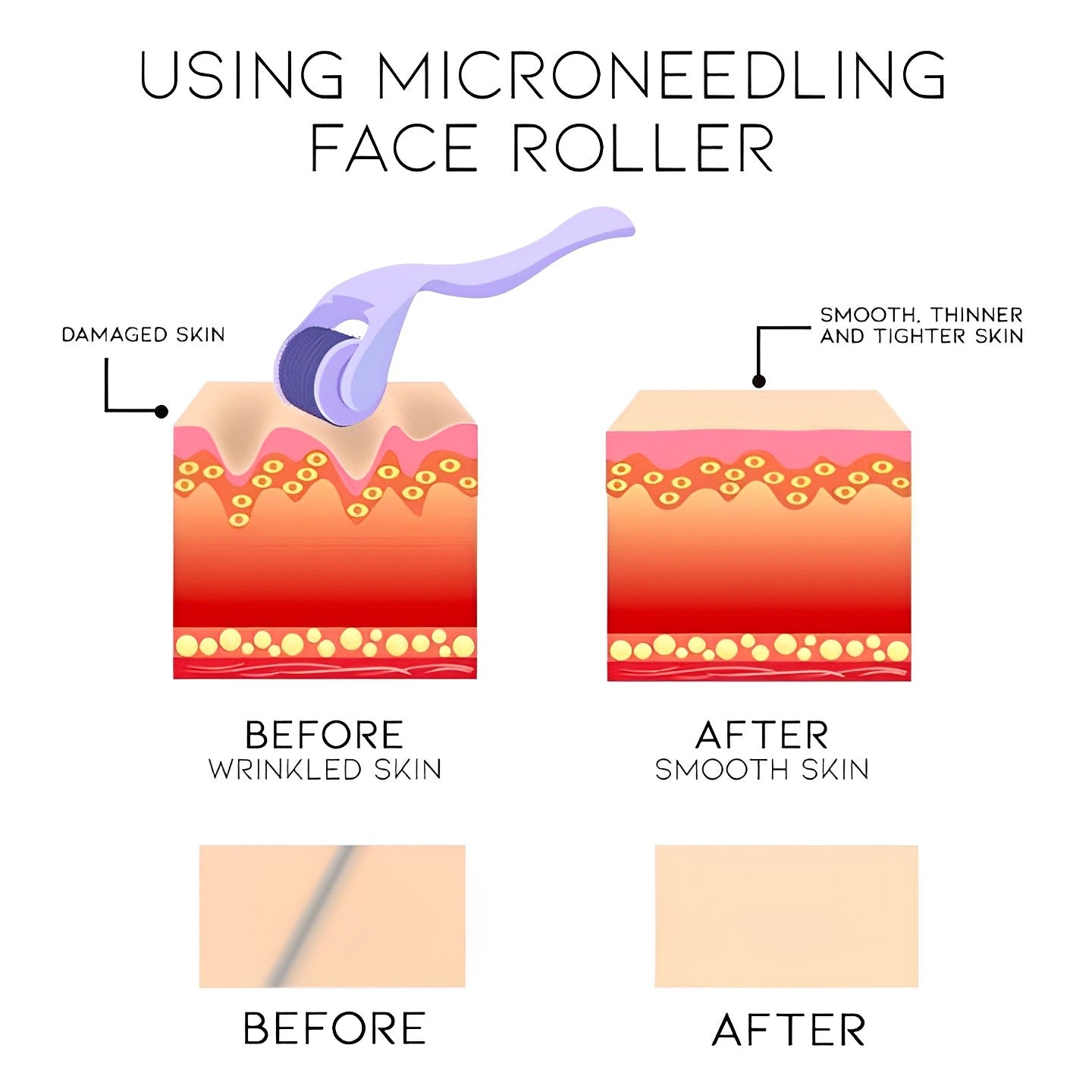Microneedling Face Roller Personal Care Every Day And Night 