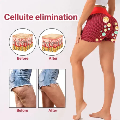 Fivfivgo™ Tourmaline Ion Breathable Lift&Shape Shorts