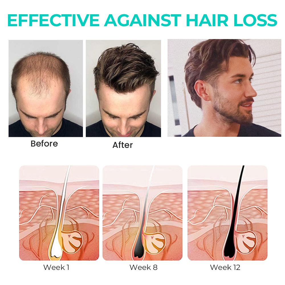 Fivfivgo™ ScalpReboost NMN Haarwuchs Roller