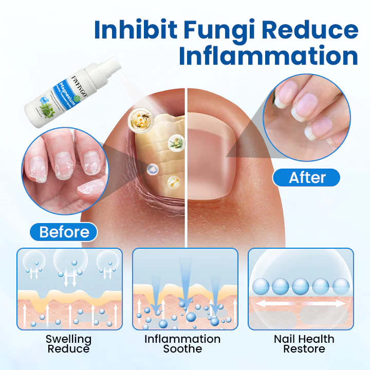 Fivfivgo® Magnesium Herbal Treatment Spray