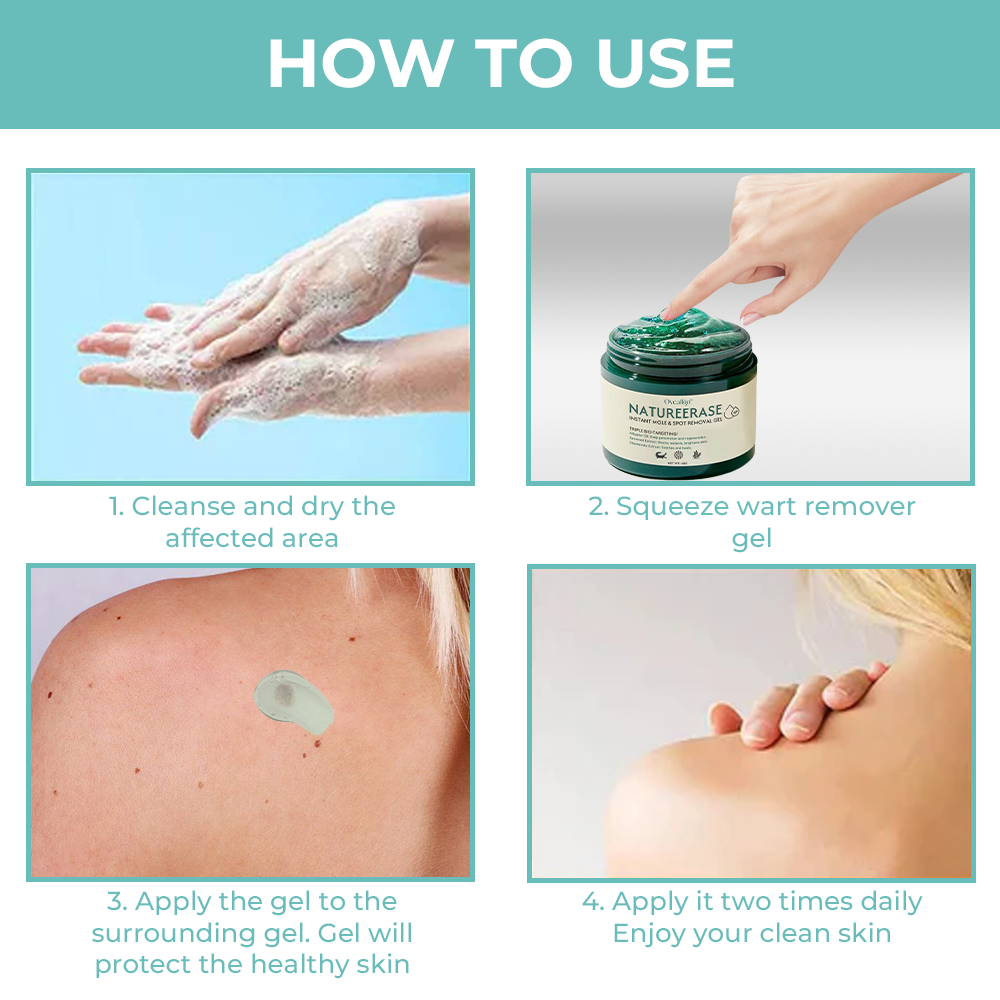 ✅ Official Store: Oveallgo® NatureErase Instant Alligator Oil Mole & Spot Removal Premium Gel