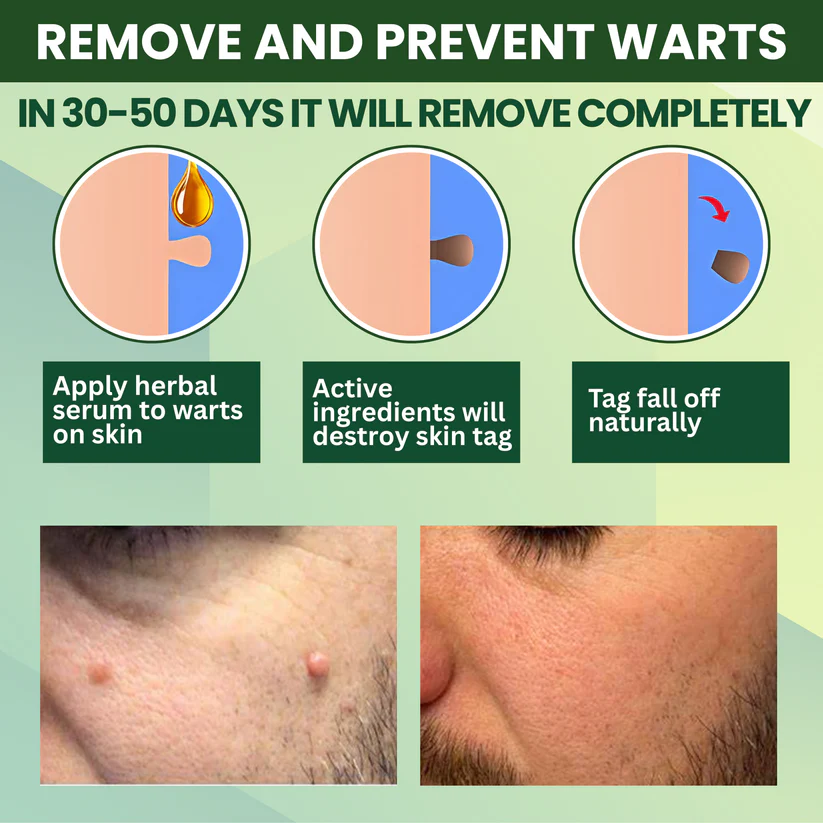 Fivfivgo® Reedle Shot 100 Tag & Spot Target Advanced Serum