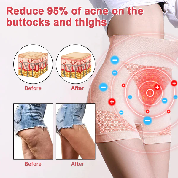 Fivfivgo™ Shapewear infrarouge lointain et d'autonomisation des ions