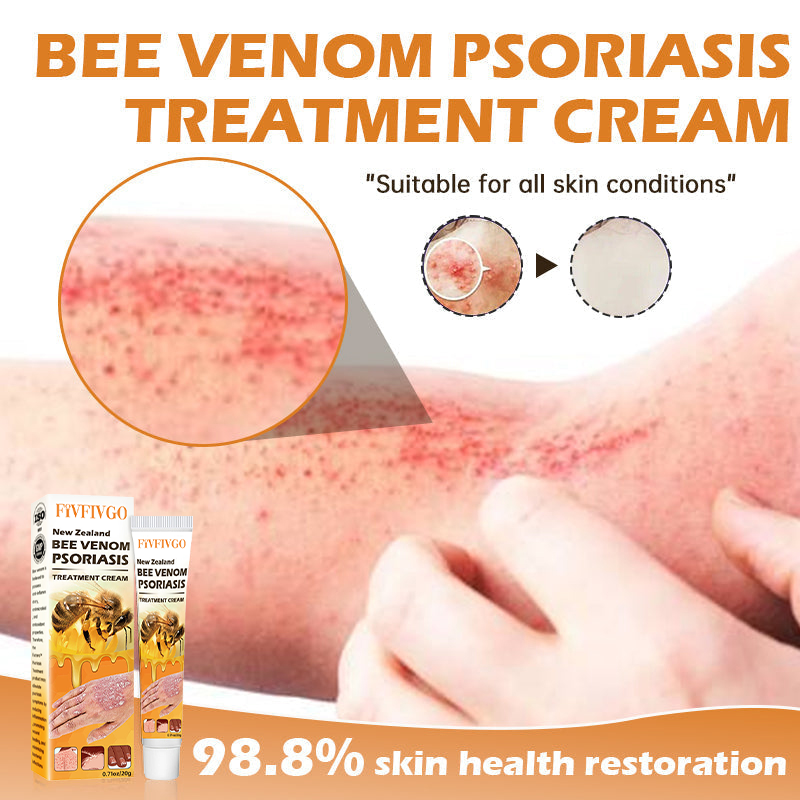 Fivfivgo™ Neuseeland Bienengift Psoriasis Behandlung Creme