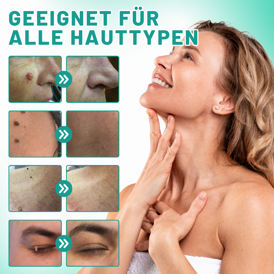 Fivfivgo™ 2-in1 Haut Tag Entfernung Kit