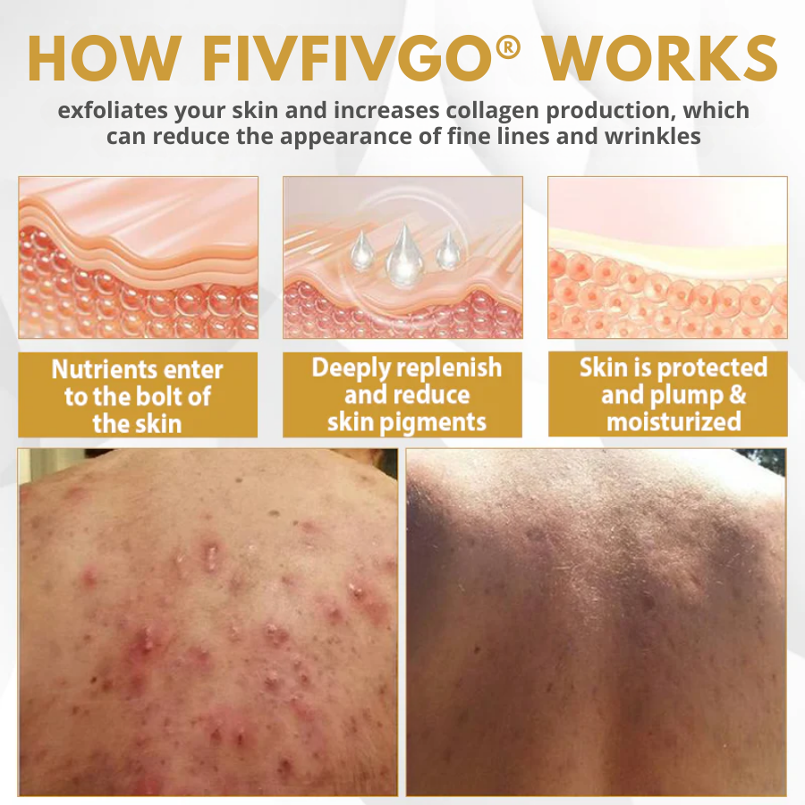 Fivfivgo® Advanced Mole & Spot Correcting Bee Gel