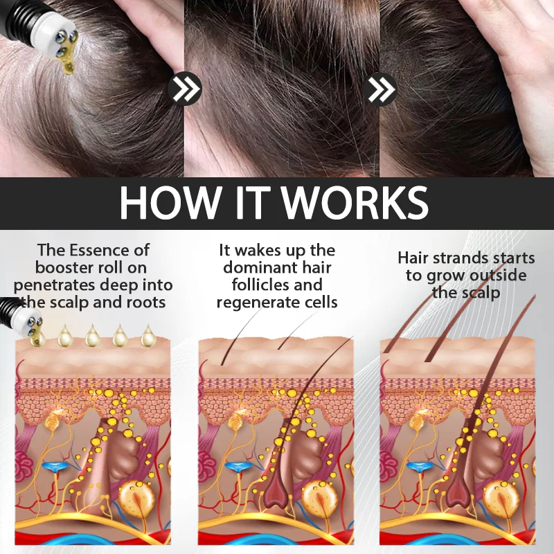 Fivfivgo™ Alopecia Recovery Hair Booster Roll-On