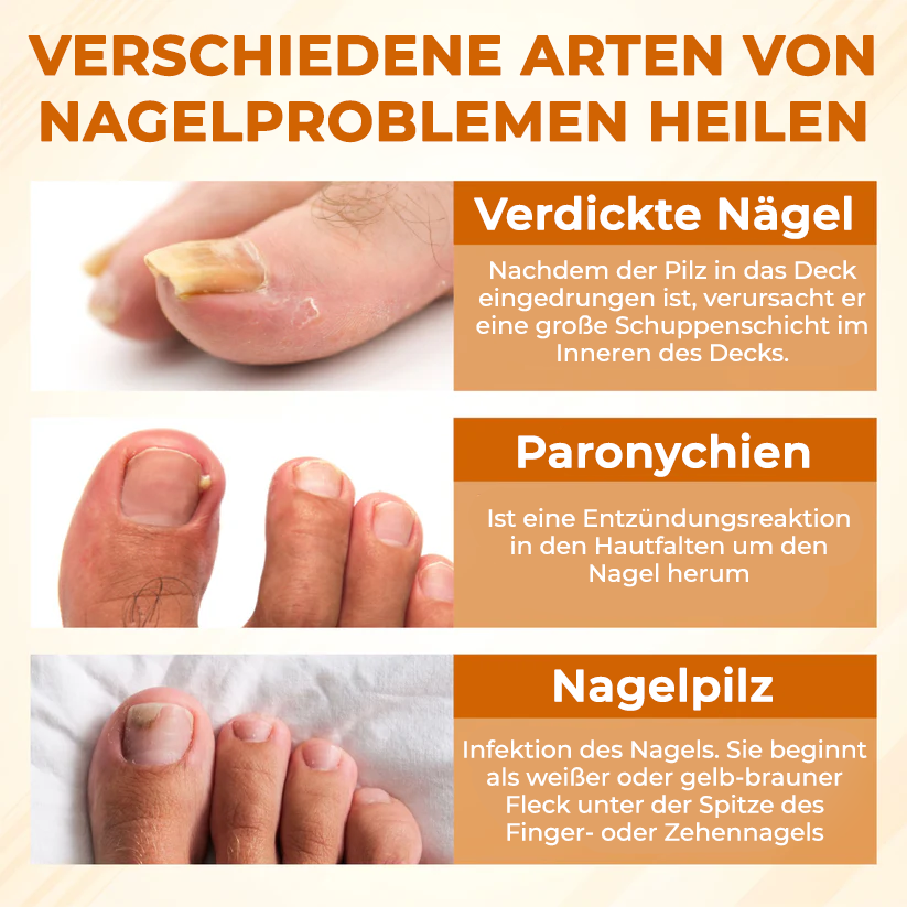 Fivfivgo® Fungiclear Bienen Therapie Nagelspray