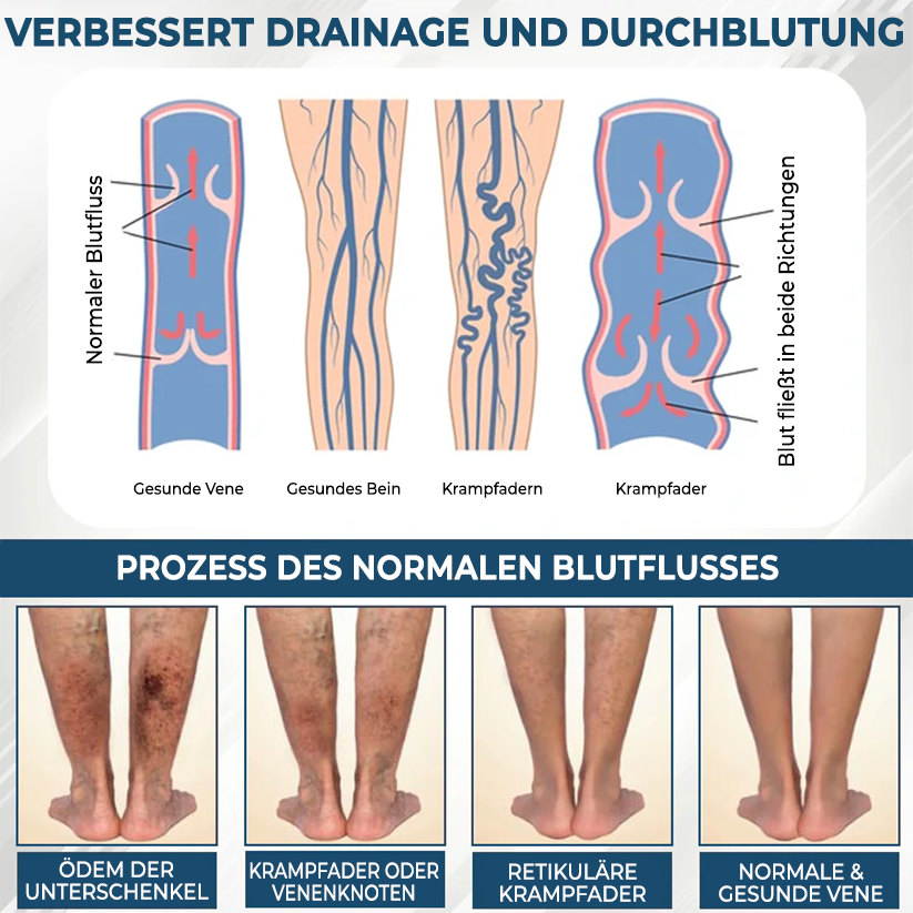 Fivfivgo® VenoHerb Schwarzkümmel-Ödemlöser-Balsam