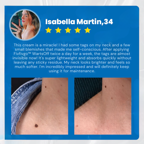 Fivfivgo™ WartsOff Instant Blemish Removal Cream👩‍⚕️USA Dermatology Association (AADA) Approved (Skin Tags, Warts, Dark Spots Removal)