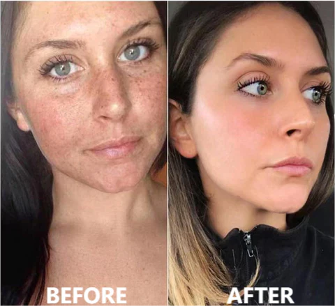 Sérum anti-âge Fivfivgo™ Collagen Boost pour éliminer 97 % des rides profondes et des taches brunes