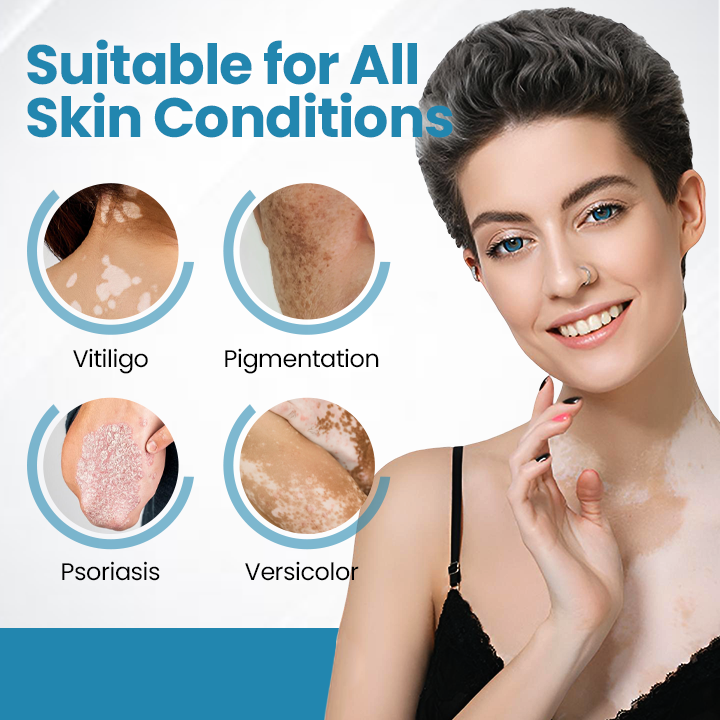 Bikenda® Vitiligo Light Therapy Device