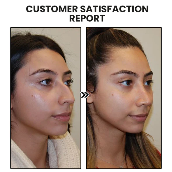 Orecchini Fivfivgo™ EarAcupressure Magnet Therapy Detoxi