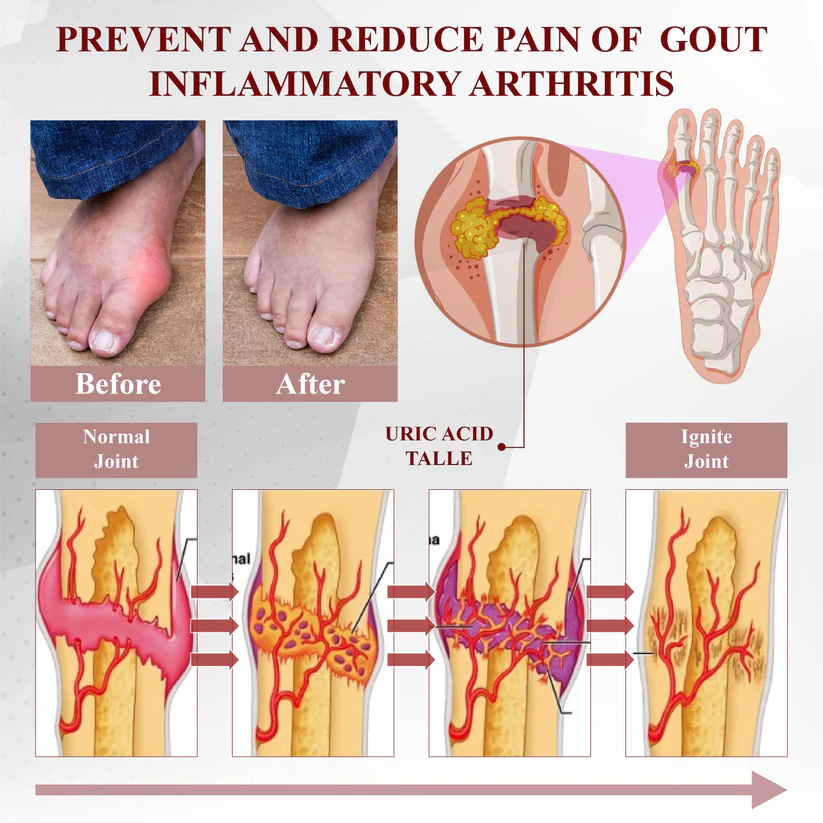 Fivfivgo™ Rosskastanie Arthritis-Massagecreme