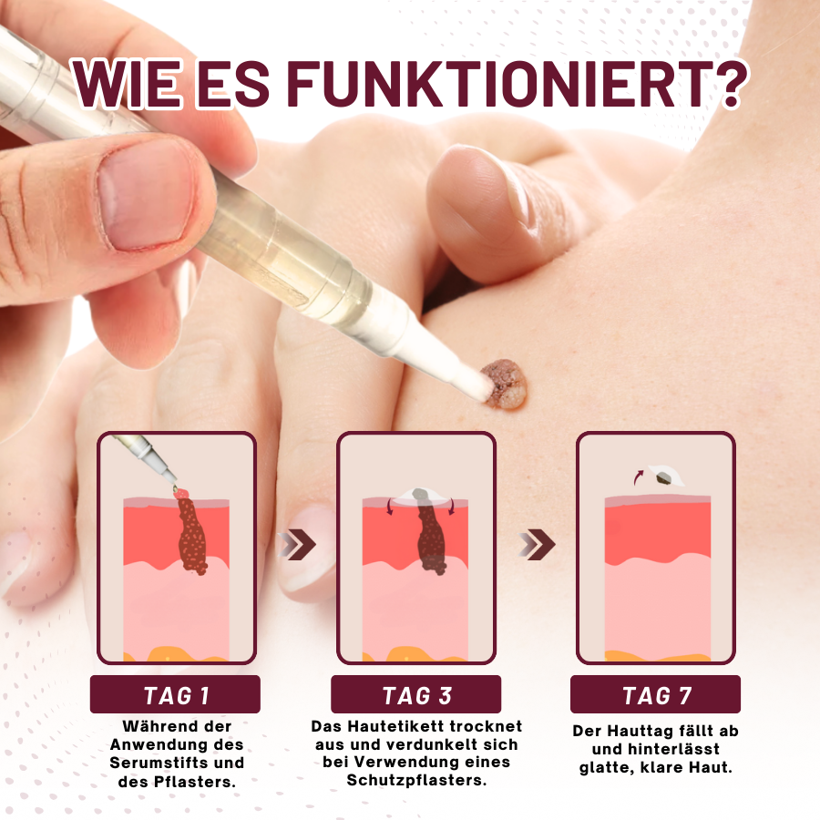 Fivfivgo™ Haut Tag Entfernungsaufkleber