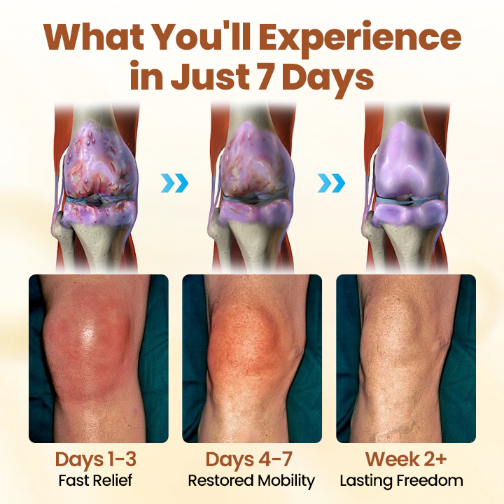 NovaRX® Premium Curcumin Pain Relief Gel