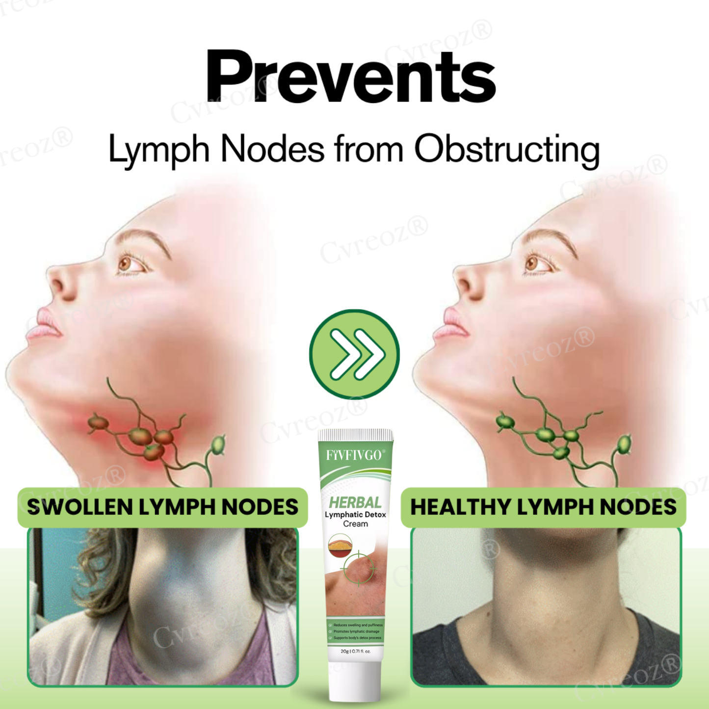 Fivfivgo® Herbal Lymphatic Detox Cream