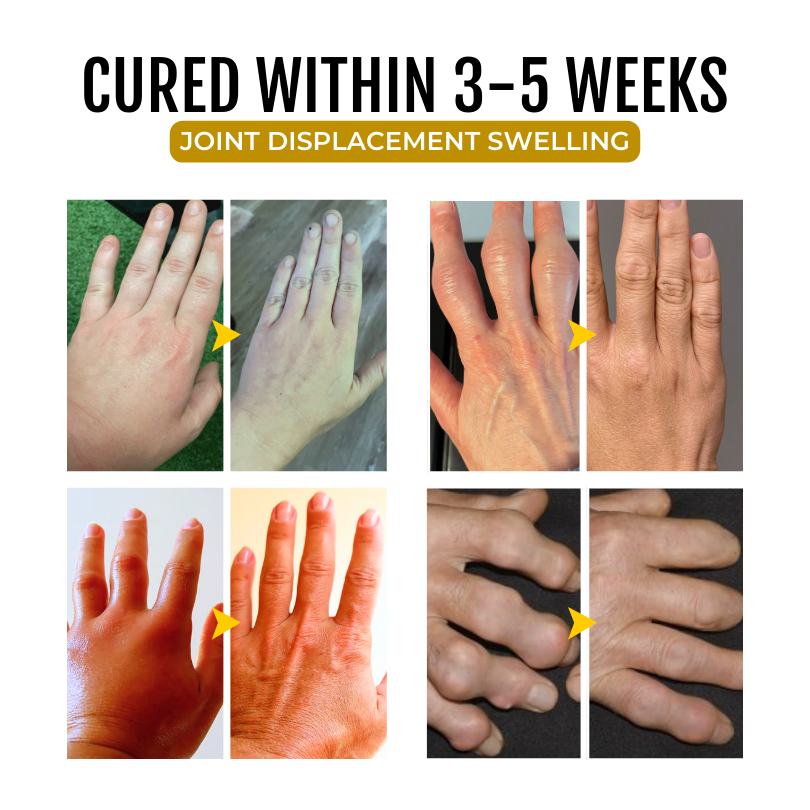 Fivfivgo® ArthroSoothe Turmeric & Emu Oil Pain Relief Massage Gel