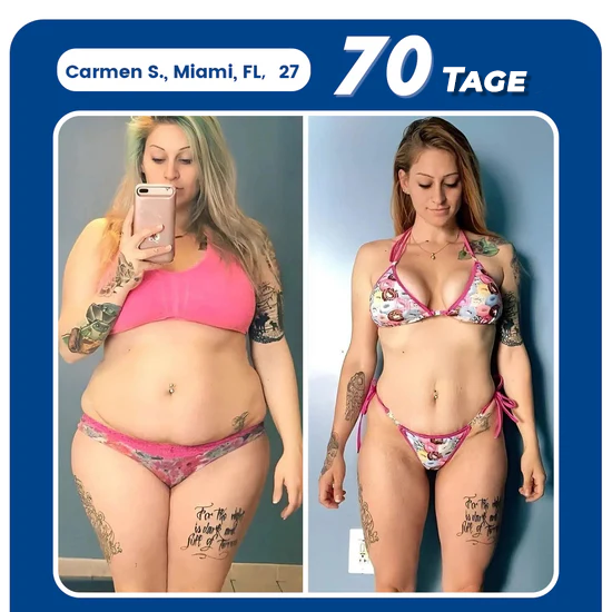 Oveallgo® PDRN-GLP-1 Schlankheitsmittel und blutzuckerregulierendes Reedle Shot Serum