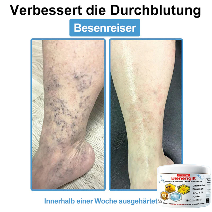 Fivfivgo™ Bienengift Creme Zur Behandlung Multi-symptom
